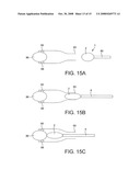 Obstetric Vacuum Extractor diagram and image