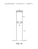 Obstetric Vacuum Extractor diagram and image