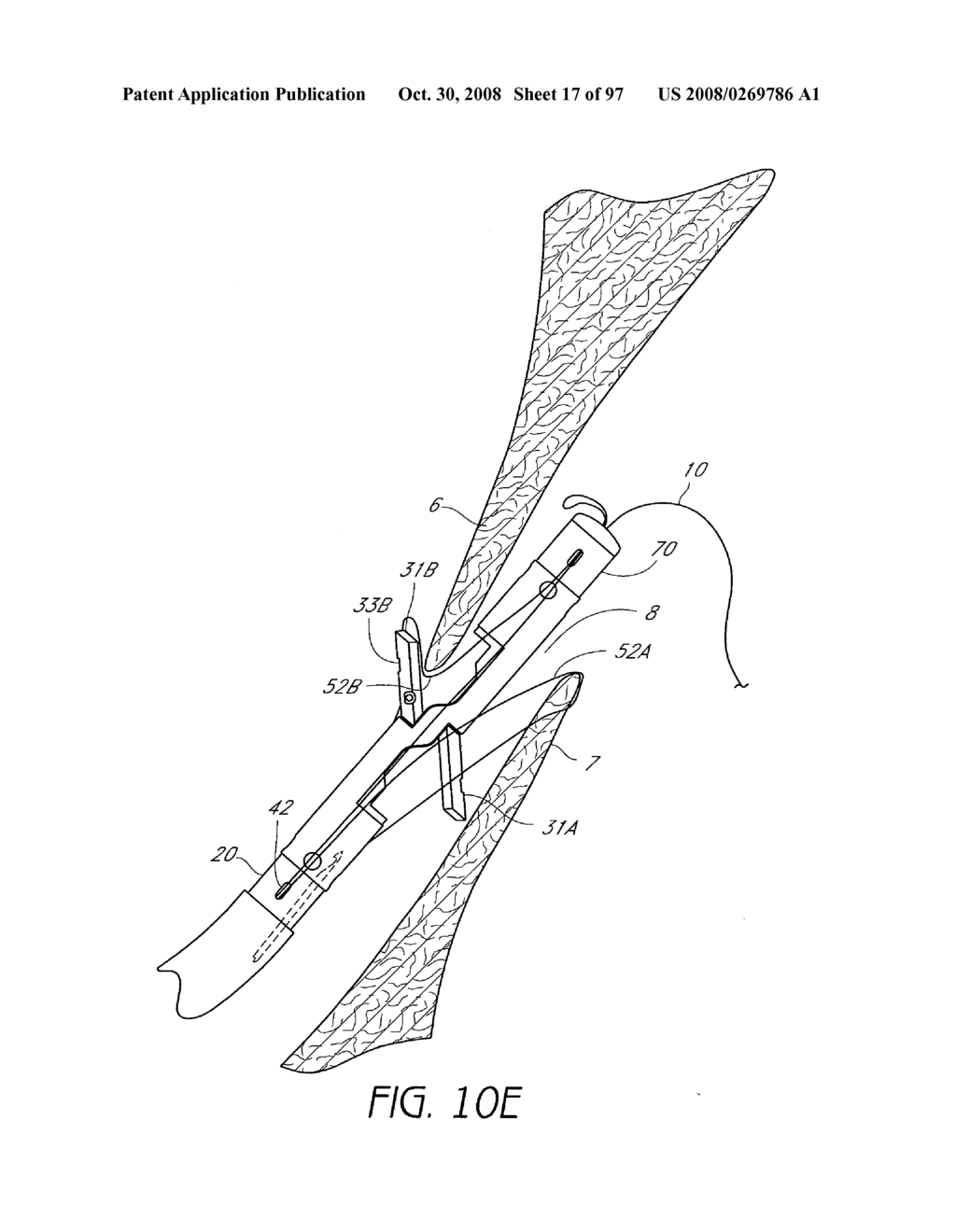 Suturing Devices and Methods for Closing a Patent Foramen Ovale - diagram, schematic, and image 18