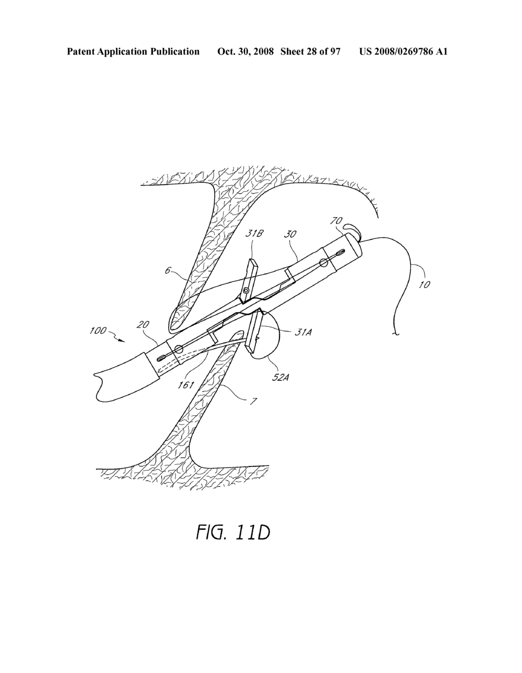 Suturing Devices and Methods for Closing a Patent Foramen Ovale - diagram, schematic, and image 29