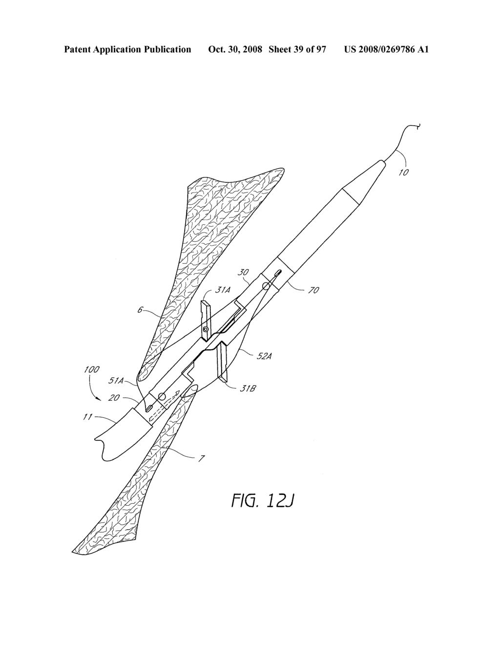 Suturing Devices and Methods for Closing a Patent Foramen Ovale - diagram, schematic, and image 40