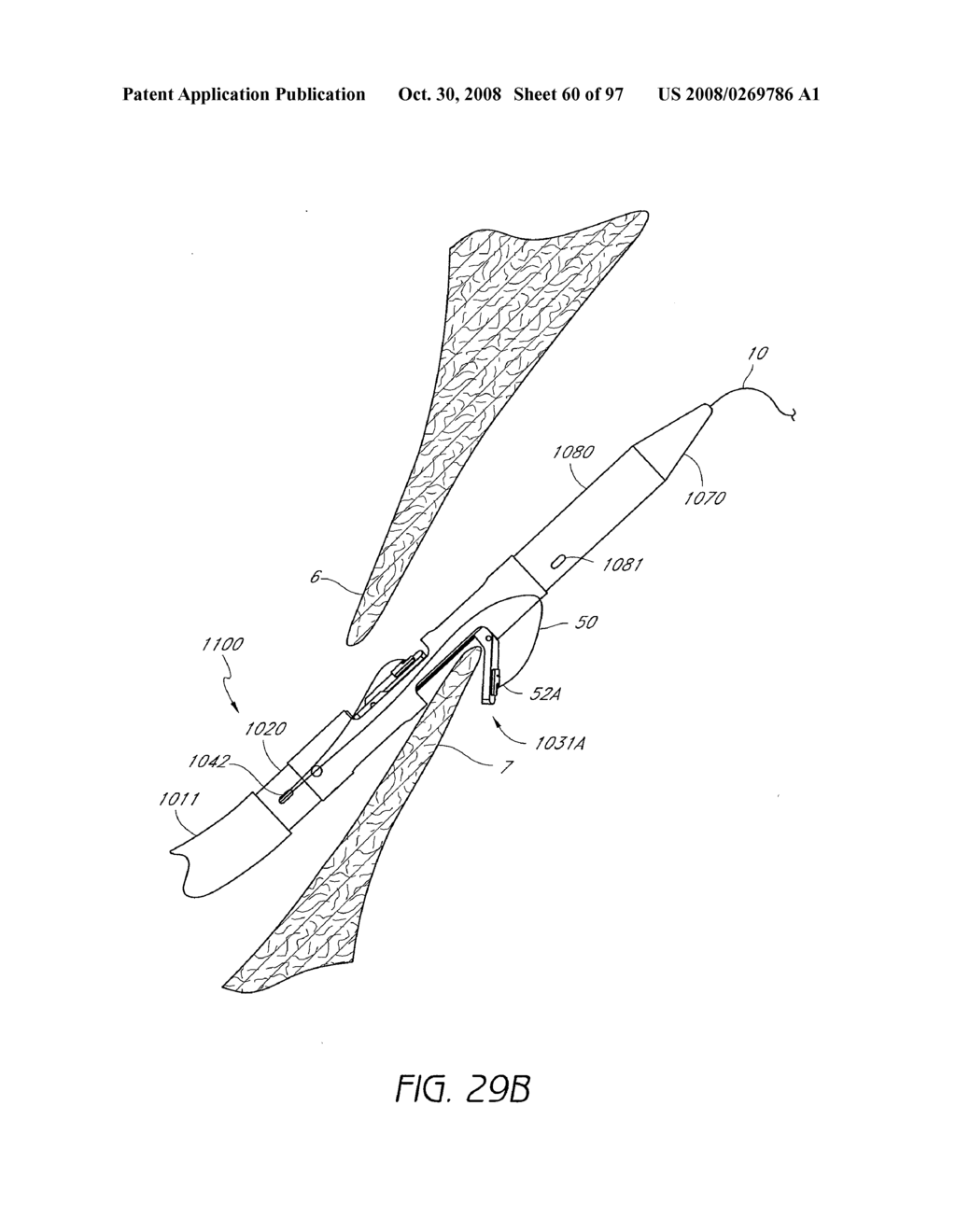 Suturing Devices and Methods for Closing a Patent Foramen Ovale - diagram, schematic, and image 61