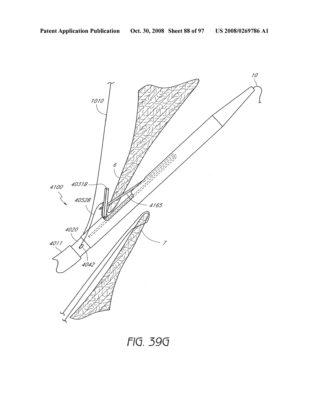 Suturing Devices and Methods for Closing a Patent Foramen Ovale - diagram, schematic, and image 89