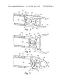 ARTERIOTOMY CLOSURE SYSTEM WITH DUAL LUMENS SHEATH diagram and image