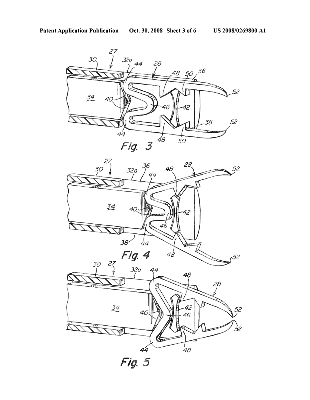 ARTERIOTOMY CLOSURE SYSTEM WITH DUAL LUMENS SHEATH - diagram, schematic, and image 04