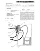 Trans-esophageal vagus nerve stimulation diagram and image