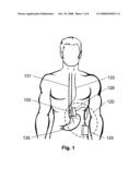 Trans-esophageal vagus nerve stimulation diagram and image