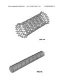 Method for Preparing Medical Stents diagram and image