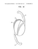 INTRAOCULAR LENS WITH ASYMMETRIC OPTICS diagram and image