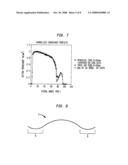 IOL Peripheral Surface Designs to Reduce Negative Dysphotopsia diagram and image