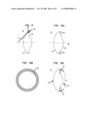 IOL Peripheral Surface Designs to Reduce Negative Dysphotopsia diagram and image