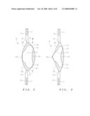 HYDROLIC ACCOMMODATING INTRAOCULAR LENS diagram and image