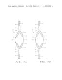 HYDROLIC ACCOMMODATING INTRAOCULAR LENS diagram and image