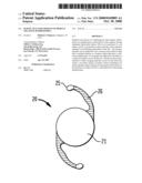 Haptic Junction Designs to Reduce Negative Dysphotopsia diagram and image