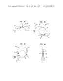 Haptic Junction Designs to Reduce Negative Dysphotopsia diagram and image