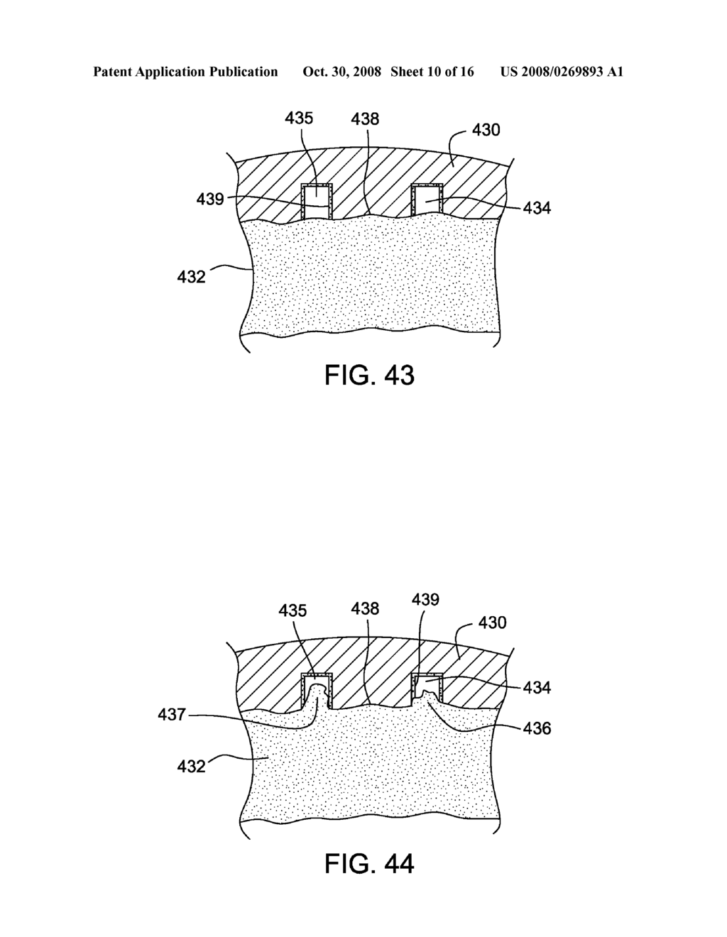 Prosthesis with a Selectively Applied Bone Growth Promoting Agent - diagram, schematic, and image 11