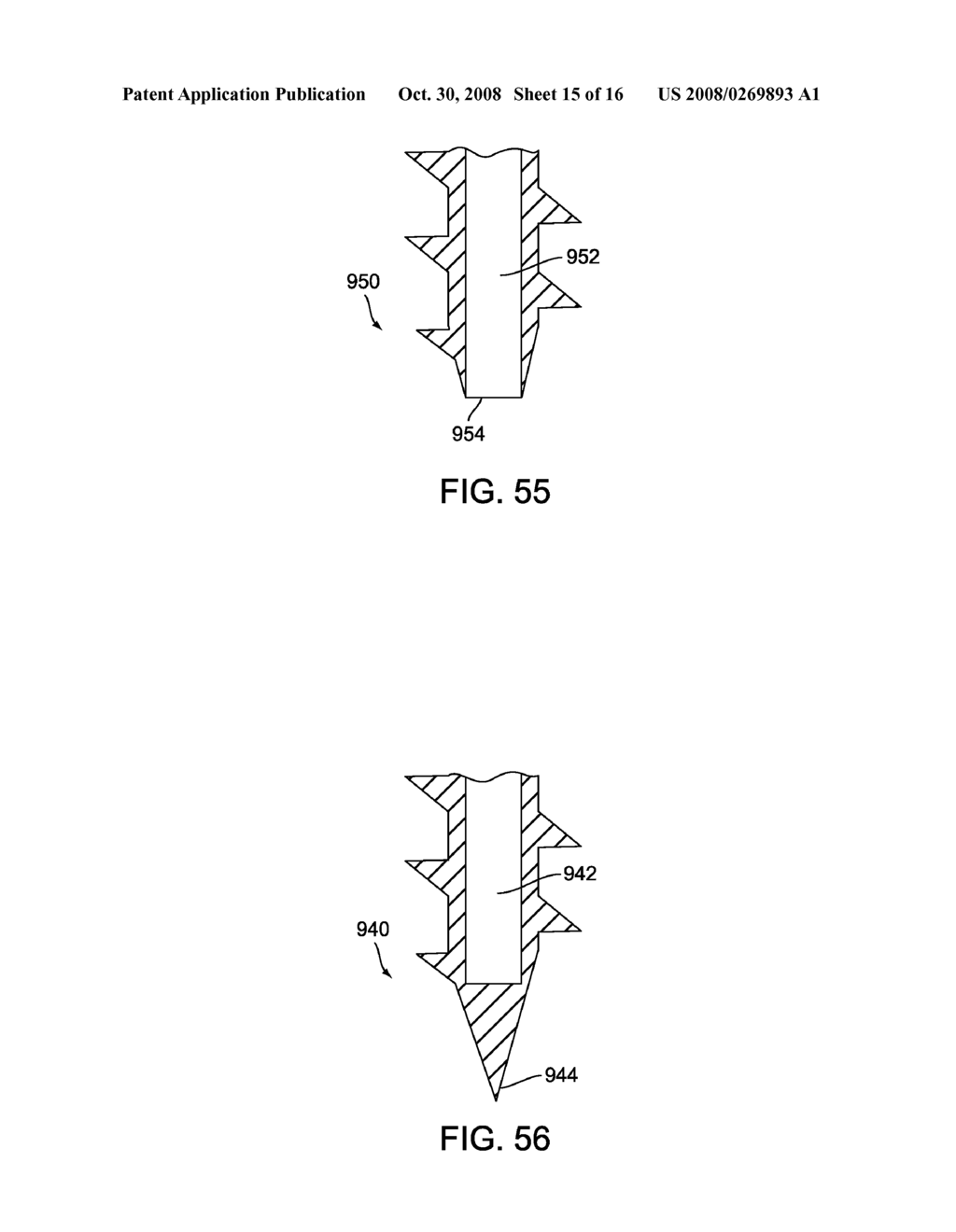 Prosthesis with a Selectively Applied Bone Growth Promoting Agent - diagram, schematic, and image 16