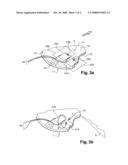 DEVICE AND METHOD FOR DETECTING LIGHTNING STRIKES ON A STRUCTURE MADE OF ELECTRICALLY INSULATING MATERIAL diagram and image