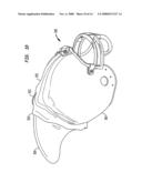 Article with 3-dimensional secondary element diagram and image