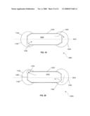 Particle burner disposed between an engine and a turbo charger diagram and image