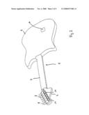 Method For Improving The Acoustic Properties, Especially The Sustain, Of A String Instrument, And Fixing Plate For Fixing One End Of The Strings Of A Guitar diagram and image