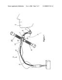 Patient Ventilating And Aspirating System diagram and image