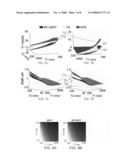 ARTIFACT REDUCTION IN STEADY-STATE FREE PRECESSION IMAGING diagram and image