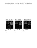 ARTIFACT REDUCTION IN STEADY-STATE FREE PRECESSION IMAGING diagram and image