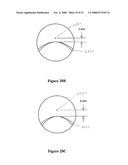 Multifocal Lens Having a Progressive Optical Power Region and a Discontinuity diagram and image