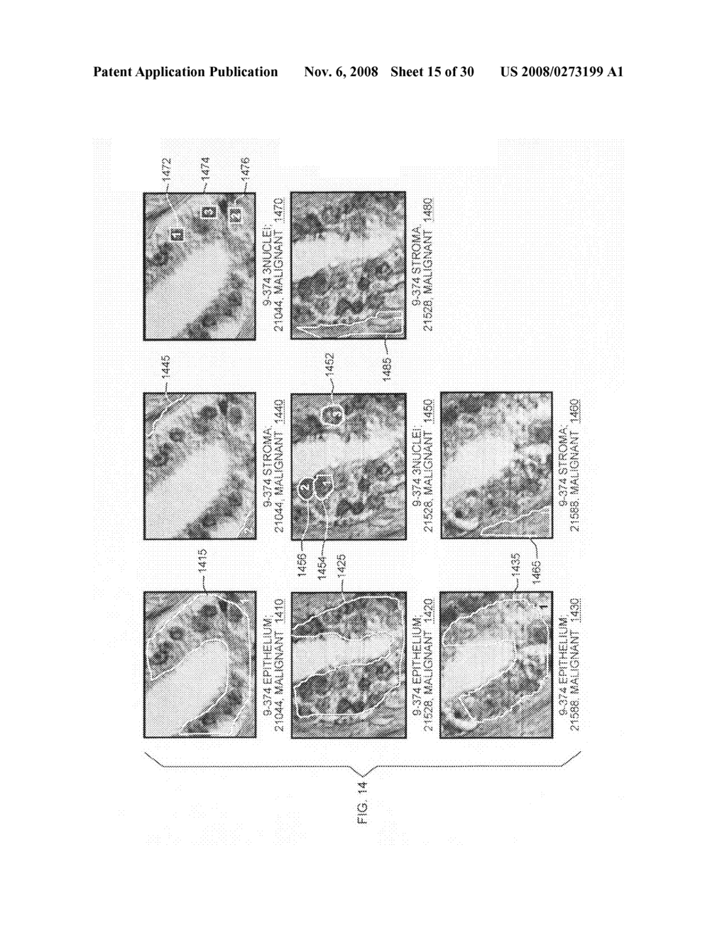 Spectroscopic system and method for predicting outcome of disease - diagram, schematic, and image 16