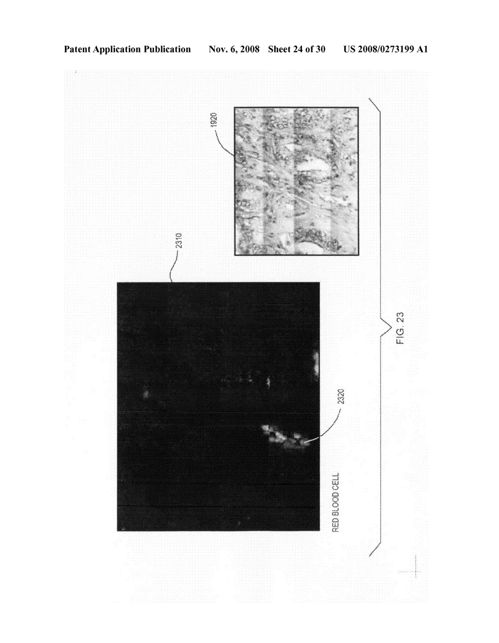 Spectroscopic system and method for predicting outcome of disease - diagram, schematic, and image 25