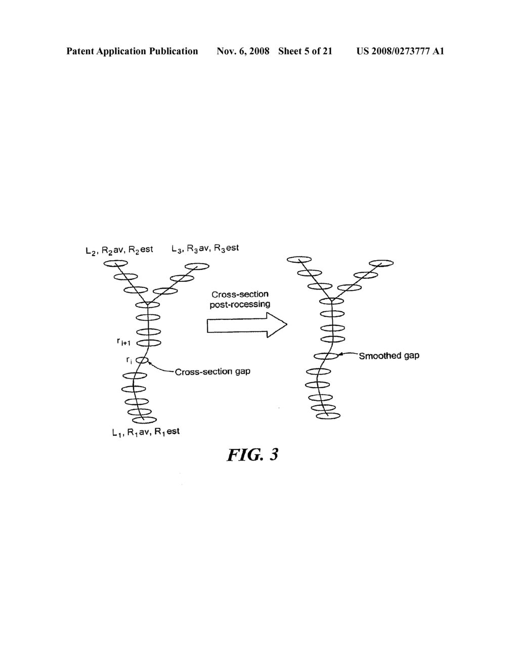 Methods And Apparatus For Segmentation And Reconstruction For Endovascular And Endoluminal Anatomical Structures - diagram, schematic, and image 06