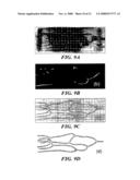 Methods And Apparatus For Segmentation And Reconstruction For Endovascular And Endoluminal Anatomical Structures diagram and image