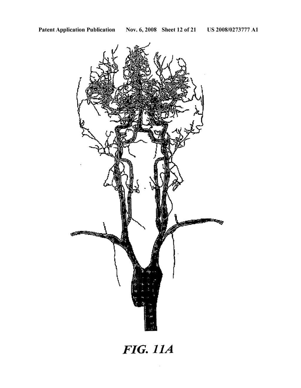 Methods And Apparatus For Segmentation And Reconstruction For Endovascular And Endoluminal Anatomical Structures - diagram, schematic, and image 13