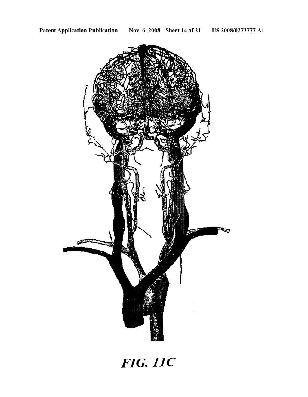 Methods And Apparatus For Segmentation And Reconstruction For Endovascular And Endoluminal Anatomical Structures - diagram, schematic, and image 15