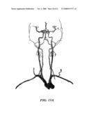 Methods And Apparatus For Segmentation And Reconstruction For Endovascular And Endoluminal Anatomical Structures diagram and image