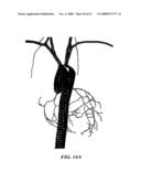 Methods And Apparatus For Segmentation And Reconstruction For Endovascular And Endoluminal Anatomical Structures diagram and image