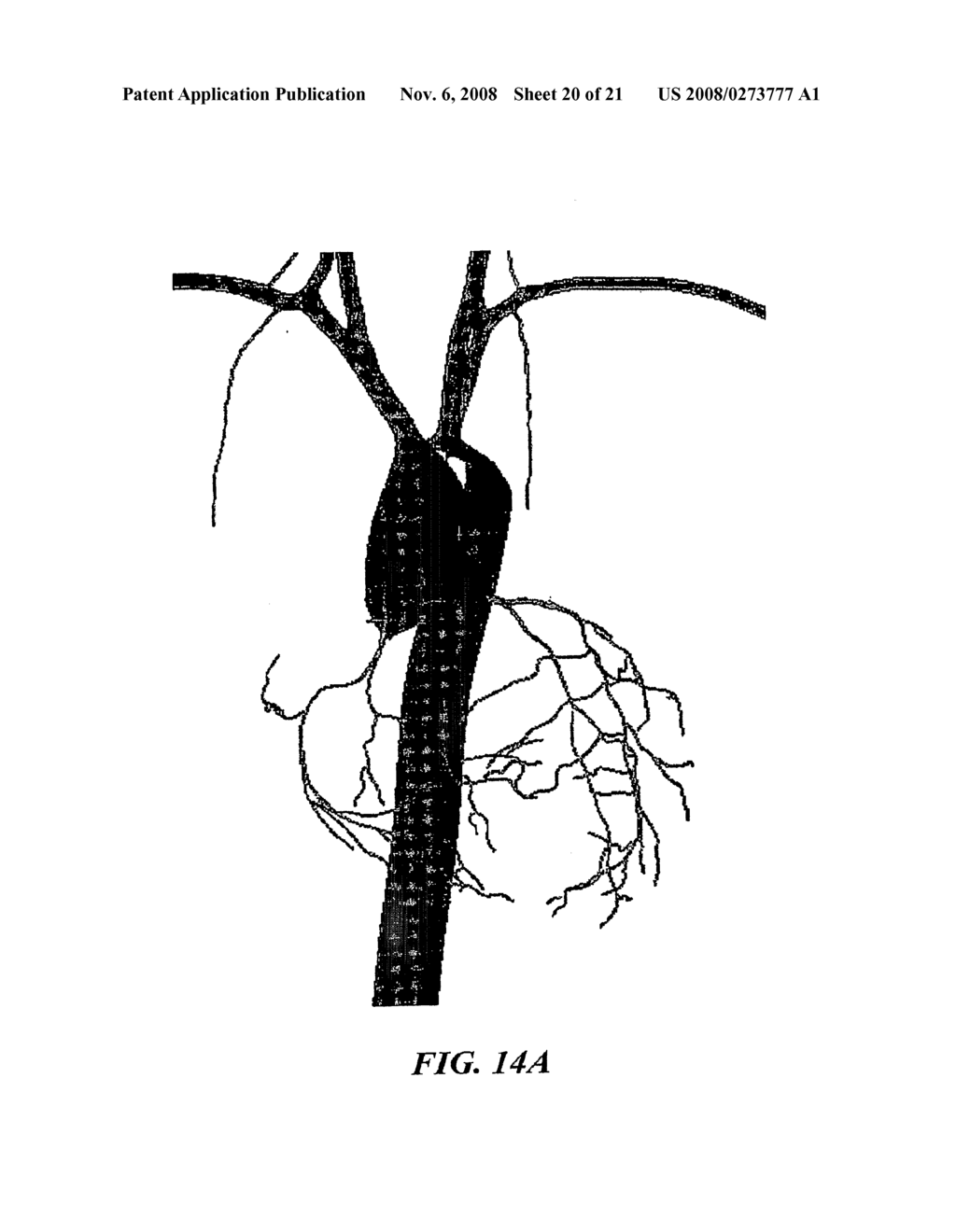 Methods And Apparatus For Segmentation And Reconstruction For Endovascular And Endoluminal Anatomical Structures - diagram, schematic, and image 21