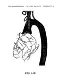 Methods And Apparatus For Segmentation And Reconstruction For Endovascular And Endoluminal Anatomical Structures diagram and image