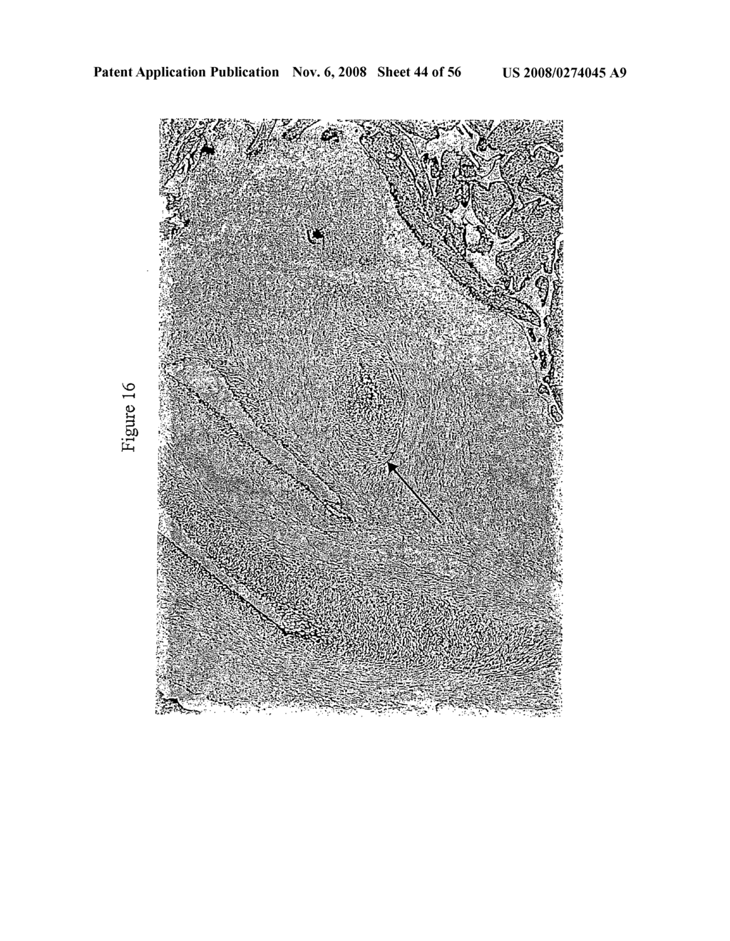 Imaging, diagnosis and treatment of disease - diagram, schematic, and image 45