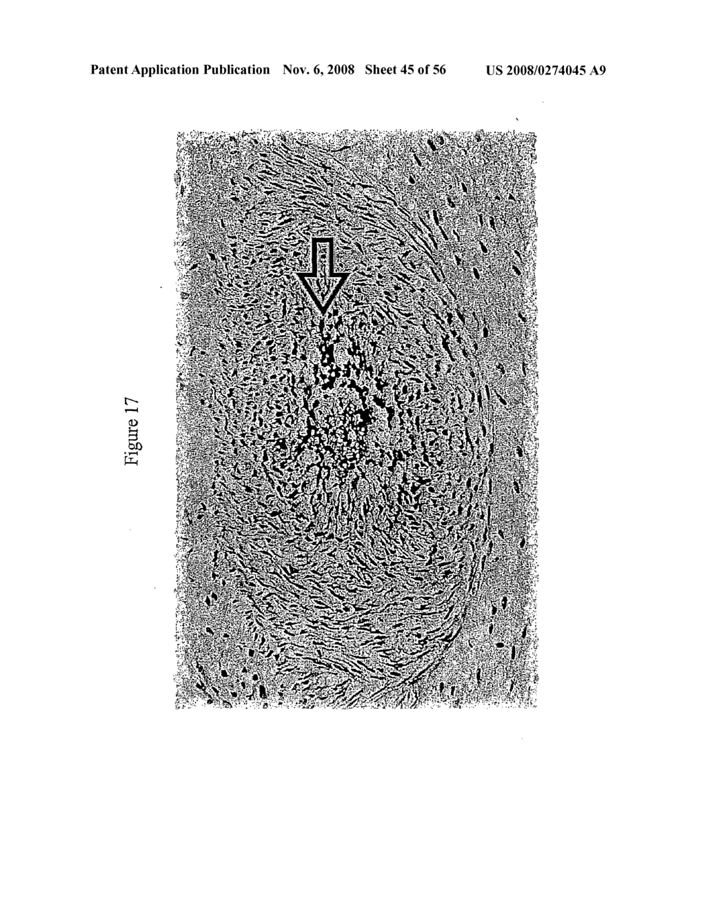 Imaging, diagnosis and treatment of disease - diagram, schematic, and image 46