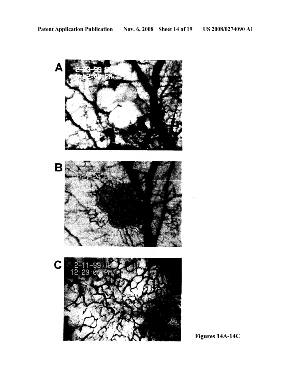 REVERSAL OF INSULIN-DEPENDENT DIABETES BY ISLET-PRODUCING STEM CELLS, ISLET PROGENITOR CELLS AND ISLET-LIKE STRUCTURES - diagram, schematic, and image 15