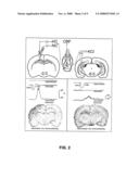 Compositions and Method for Brain Specific Targeted Delivery of Therapeutic Agents diagram and image