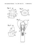 Dental Implant Abutment diagram and image