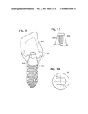 Dental Implant Abutment diagram and image