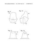 Dental Implant Abutment diagram and image