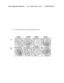 Use of Serum/Glucocorticoid-Regulated Kinase diagram and image