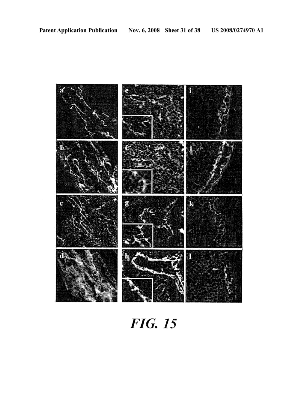 VASCULAR ADHESION MOLECULES AND MODULATION OF THEIR FUNCTION - diagram, schematic, and image 32