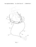 PERICARDIAL INSERTS diagram and image