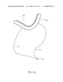 PERICARDIAL INSERTS diagram and image